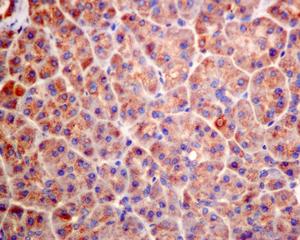 - Anti-Guanylyl Cyclase beta 1 antibody [EPR8822] (ab154841)