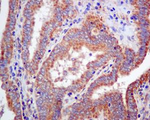 - Anti-Guanylyl Cyclase beta 1 antibody [EPR8822] (ab154841)