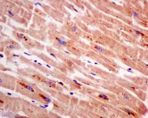 Immunohistochemistry (Formalin/PFA-fixed paraffin-embedded sections)-Anti-Guanylyl Cyclase beta 1 antibody [EPR8822](ab154841)