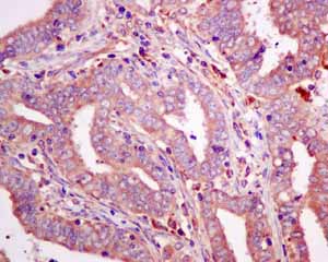 Immunohistochemistry (Formalin/PFA-fixed paraffin-embedded sections)-Anti-Guanylyl Cyclase beta 1 antibody [EPR8822](ab154841)