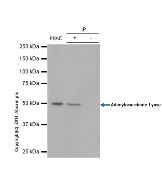 Immunoprecipitation - Anti-Adenylosuccinate Lyase antibody [EPR10746(B)] (ab154872)