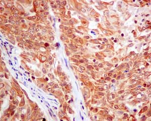 Immunohistochemistry (Formalin/PFA-fixed paraffin-embedded sections) - Anti-CKS2 antibody [EPR7946(2)] (ab155078)