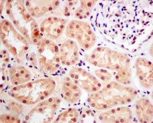 Immunohistochemistry (Formalin/PFA-fixed paraffin-embedded sections) - Anti-CKS2 antibody [EPR7946(2)] (ab155078)