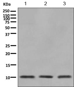 Western blot - Anti-CKS2 antibody [EPR7946(2)] (ab155078)