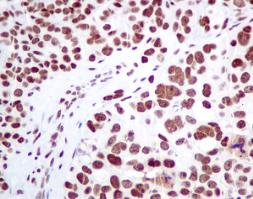 Immunohistochemistry (Formalin/PFA-fixed paraffin-embedded sections) - Anti-MPG antibody [EPR10959(B)] (ab155092)