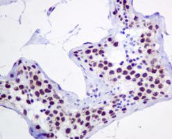 Immunohistochemistry (Formalin/PFA-fixed paraffin-embedded sections) - Anti-MPG antibody [EPR10959(B)] (ab155092)