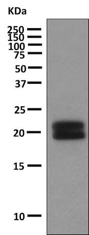 Western blot - Anti-Human Growth Hormone antibody [EPR9524] (ab155975)
