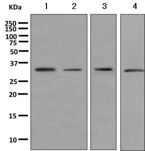 Western blot - Anti-Emerin antibody [EPR11071] (ab156871)