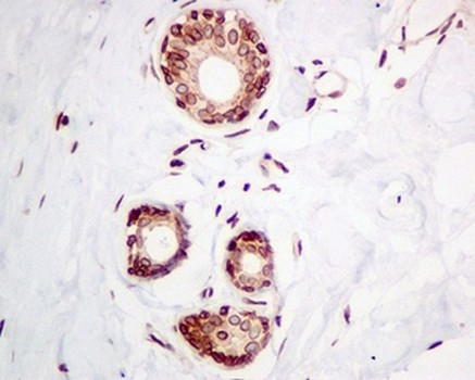 Immunohistochemistry (Formalin/PFA-fixed paraffin-embedded sections) - Anti-Emerin antibody [EPR11071] (ab156871)