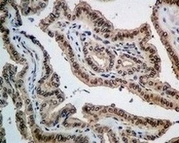 Immunohistochemistry (Formalin/PFA-fixed paraffin-embedded sections) - Anti-Emerin antibody [EPR11071] (ab156871)