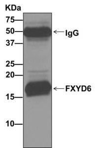 Immunoprecipitation - Anti-FXYD6 antibody [EP9005] (ab157196)