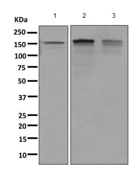 Western blot - Anti-INPPL1 antibody [EPR10954] (ab157460)