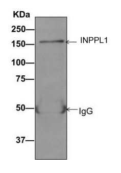 Immunoprecipitation - Anti-INPPL1 antibody [EPR10954] (ab157460)