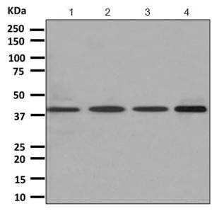 Western blot - Anti-EDG2 antibody [EPR9710] (ab166903)