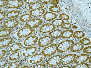 Immunohistochemistry (Formalin/PFA-fixed paraffin-embedded sections) - Anti-EDG2 antibody [EPR9710] (ab166903)