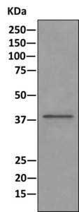 Immunoprecipitation - Anti-EDG2 antibody [EPR9710] (ab166903)