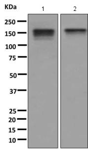 Western blot - Anti-INPPL1 antibody [EPR10955] (ab166916)