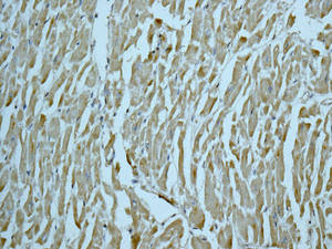 Immunohistochemistry (Formalin/PFA-fixed paraffin-embedded sections) - Anti-INPPL1 antibody [EPR10955] (ab166916)