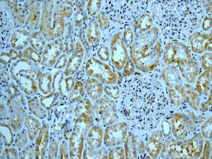 Immunohistochemistry (Formalin/PFA-fixed paraffin-embedded sections) - Anti-INPPL1 antibody [EPR10955] (ab166916)