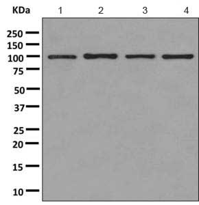 Western blot - Anti-ABR antibody [EPR7657(2)] (ab167420)