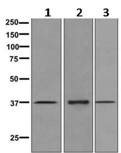 Western blot - Anti-Kallikrein 5 antibody [EPR9278] (ab168340)