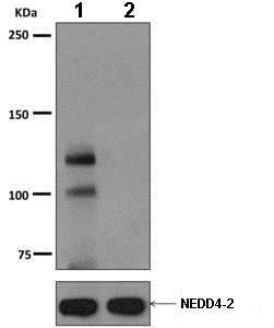 Western blot - Anti-NEDD4-2 (phospho S448) [EPR8269(2)] antibody (ab168349)