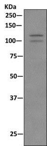 Immunoprecipitation - Anti-NEDD4-2 (phospho S448) [EPR8269(2)] antibody (ab168349)