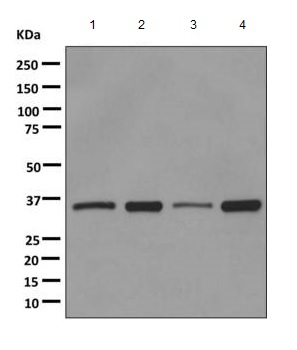 Western blot - Anti-PPP2CB antibody [EPR11787(B)] (ab168350)