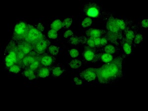Immunocytochemistry/ Immunofluorescence - Anti-PPP2CB antibody [EPR11787(B)] (ab168350)