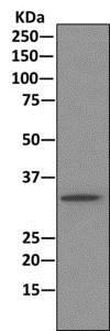Immunoprecipitation - Anti-PPP2CB [EPR11786(B)] antibody (ab168371)