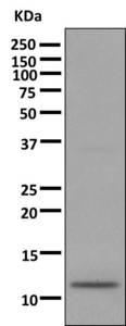 Western blot - Anti-Dynein light chain antibody [EPR11234] (ab168385)