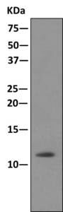 Immunoprecipitation - Anti-Dynein light chain antibody [EPR11234] (ab168385)