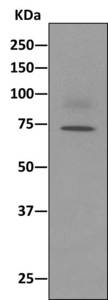 Western blot - Anti-Apc6 antibody [EPR11168] (ab169536)