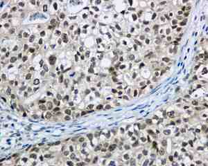 Immunohistochemistry (Formalin/PFA-fixed paraffin-embedded sections) - Anti-Apc6 antibody [EPR11168] (ab169536)