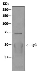 Immunoprecipitation - Anti-KBTBD11 antibody [EPR10056(2)(B)] (ab169551)