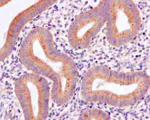 Immunohistochemistry (Formalin/PFA-fixed paraffin-embedded sections) - Anti-KBTBD11 antibody [EPR10056(2)(B)] (ab169551)