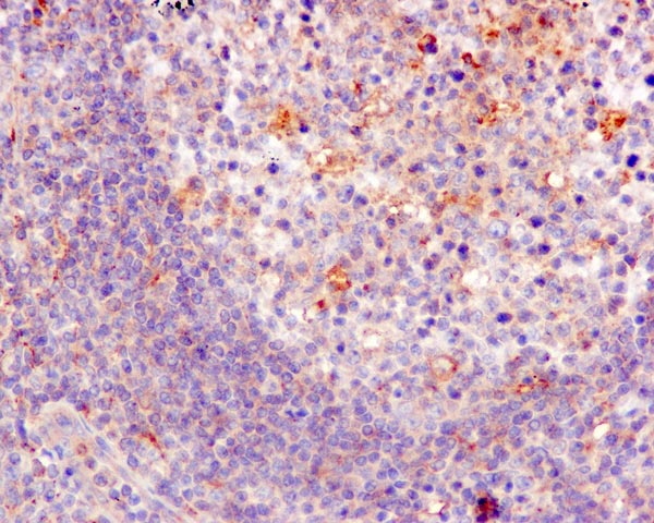 Immunohistochemistry (Formalin/PFA-fixed paraffin-embedded sections) - Anti-KBTBD11 antibody [EPR10056(2)(B)] (ab169551)