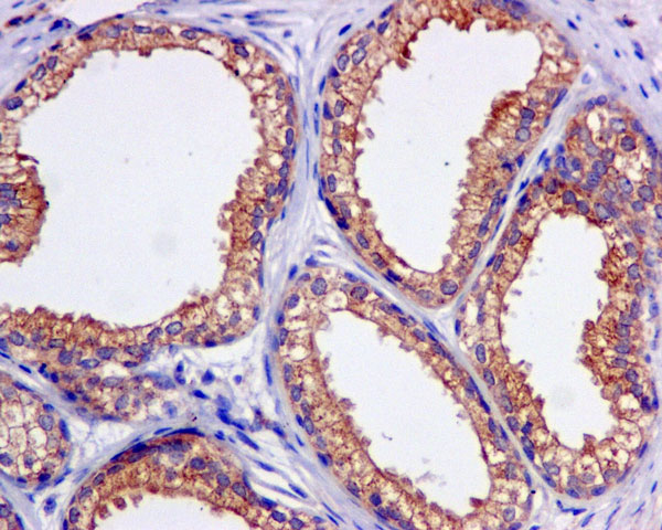 Immunohistochemistry (Formalin/PFA-fixed paraffin-embedded sections) - Anti-KBTBD11 antibody [EPR10056(2)(B)] (ab169551)