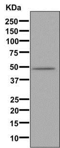 Western blot - Anti-CYP3A7 [EPR10650(2)(B)] antibody (ab169764)