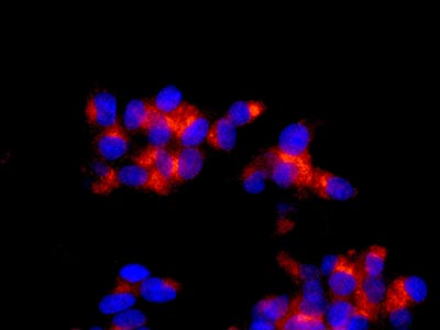 Immunocytochemistry/ Immunofluorescence - Anti-Als2 [EPR11185] antibody (ab170896)