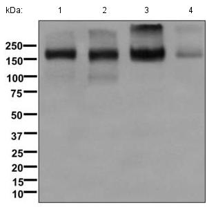 Western blot - Anti-P Glycoprotein antibody [EPR10364-57] (ab170904)