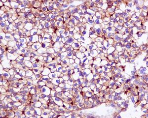 Immunohistochemistry (Formalin/PFA-fixed paraffin-embedded sections) - Anti-P Glycoprotein antibody [EPR10364-57] (ab170904)