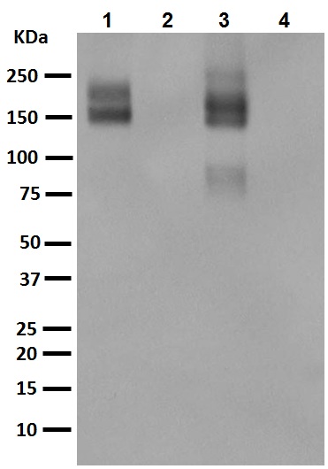 Western blot - Anti-P Glycoprotein antibody [EPR10364-57] (ab170904)
