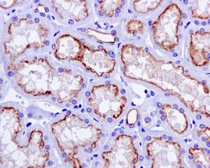 Immunohistochemistry (Formalin/PFA-fixed paraffin-embedded sections) - Anti-P Glycoprotein antibody [EPR10364-57] (ab170904)