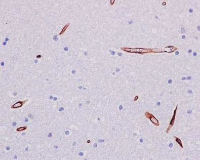 Immunohistochemistry (Formalin/PFA-fixed paraffin-embedded sections) - Anti-P Glycoprotein antibody [EPR10364-57] (ab170904)