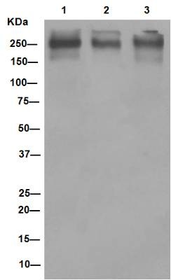 Western blot - Anti-P Glycoprotein antibody [EPR10364-57] (ab170904)