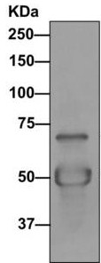 Immunoprecipitation - Anti-Dynein intermediate chain 2 [EPR11224] antibody (ab170920)