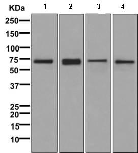 Western blot - Anti-Dynein intermediate chain 2 [EPR11224] antibody (ab170920)