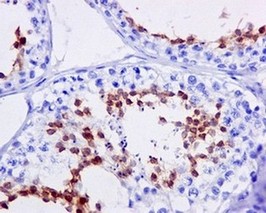 Immunohistochemistry (Formalin/PFA-fixed paraffin-embedded sections) - Anti-Dynein intermediate chain 2 [EPR11224] antibody (ab170920)