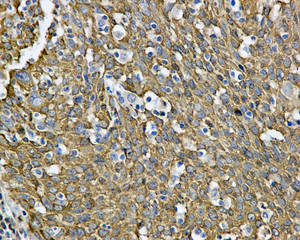Immunohistochemistry (Formalin/PFA-fixed paraffin-embedded sections) - Anti-PDZRN4 [EPR11852] antibody (ab171083)